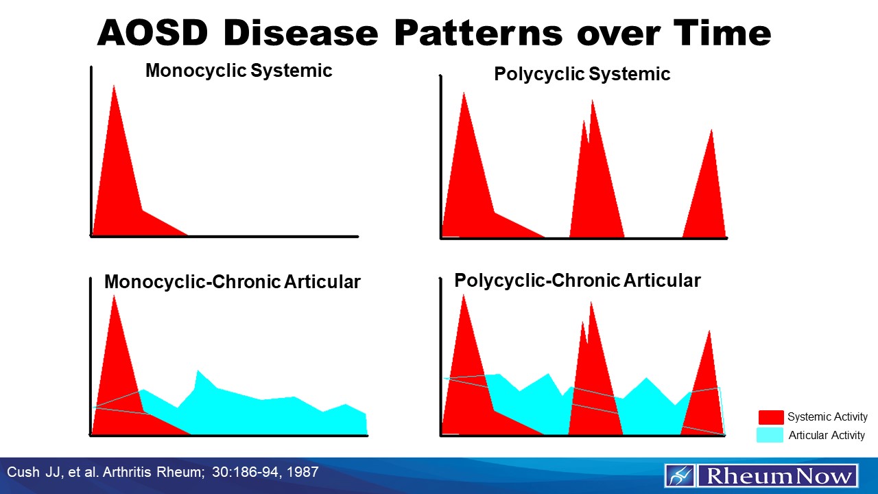 AOSD Patterns | RheumNow